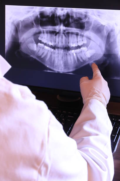 Best Emergency Dental Care for Broken or Chipped Teeth in Mccla, AL