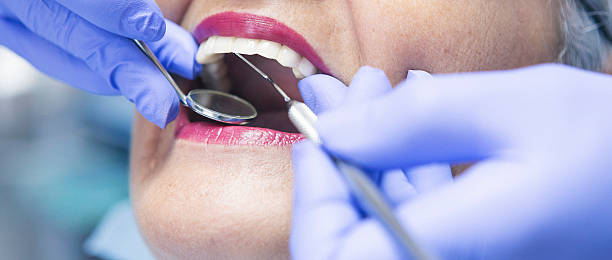 Best Emergency Denture Repair in Mccla, AL